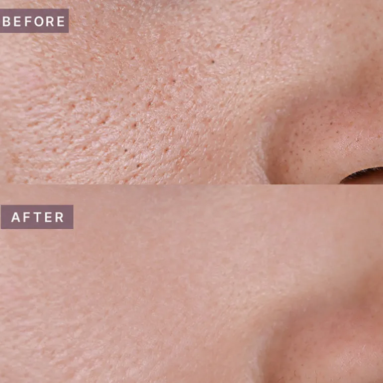 Pot Pore Tightening Podo Ampoule